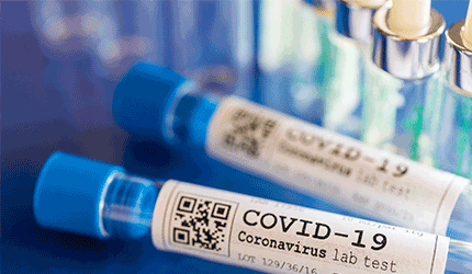 COVID_19 test tubes