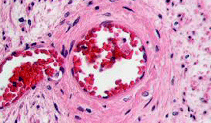 pink and red cells