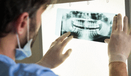 Dental x-ray teeth