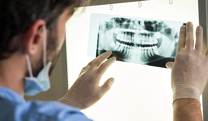 Dental x-ray teeth
